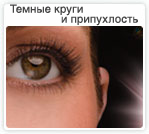 Темные круги и припухлость